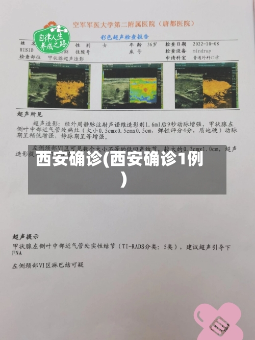 西安确诊(西安确诊1例)-第3张图片