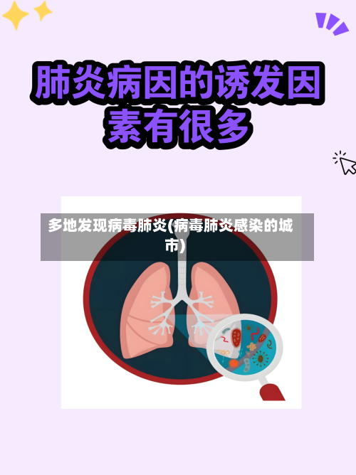 多地发现病毒肺炎(病毒肺炎感染的城市)
