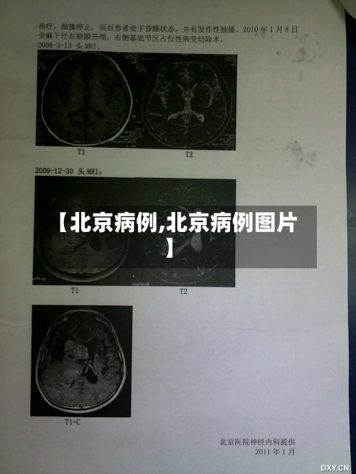 【北京病例,北京病例图片】-第1张图片