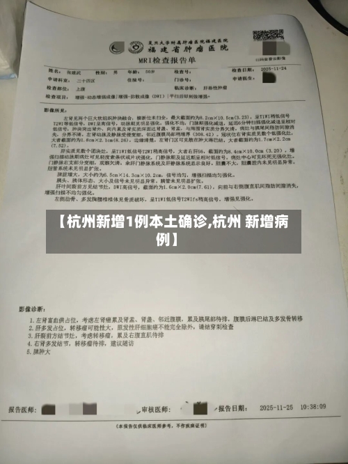 【杭州新增1例本土确诊,杭州 新增病例】-第1张图片