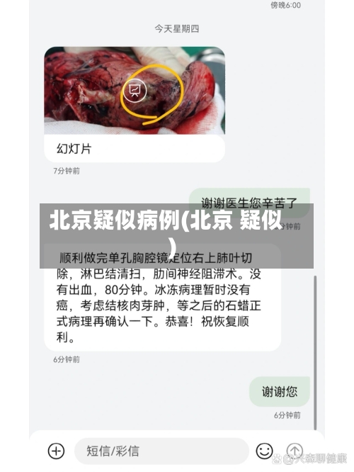 北京疑似病例(北京 疑似)-第2张图片