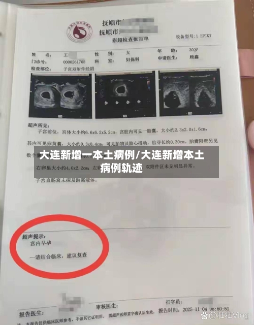 大连新增一本土病例/大连新增本土病例轨迹-第3张图片