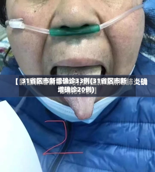 31省区市新增确诊33例(31省区市新增确诊20例)-第1张图片