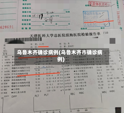 乌鲁木齐确诊病例(乌鲁木齐市确诊病例)-第1张图片