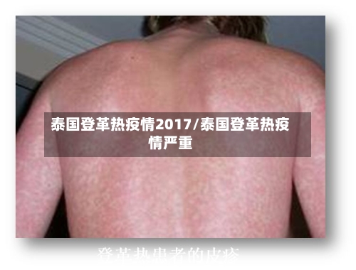 泰国登革热疫情2017/泰国登革热疫情严重-第1张图片